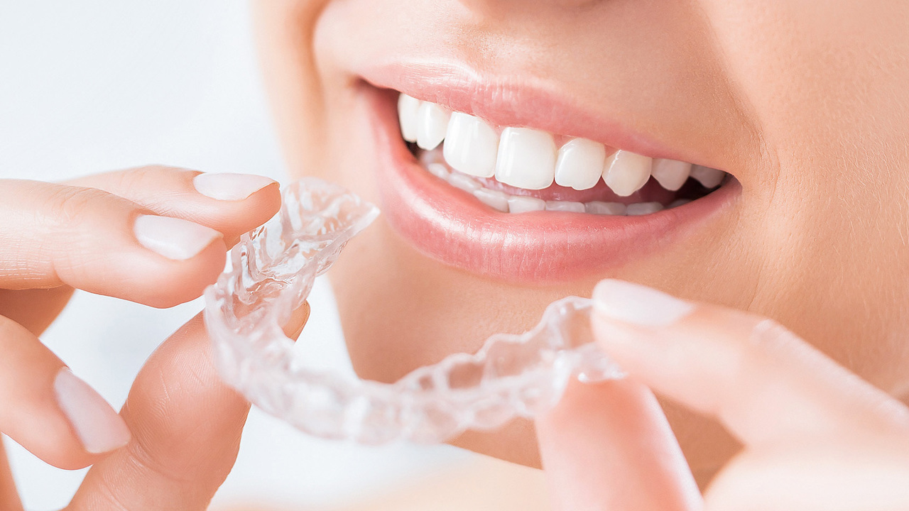 安いおすすめマウスピース矯正インビザライン - 西宮市矯正歯科相談室