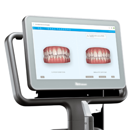 マウスピース矯正のAIシステム - 西宮矯正歯科相談室（西宮・西宮市・甲陽園）