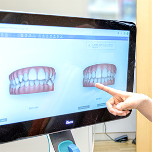 院長がモニターを使って患者に説明を行っている写真