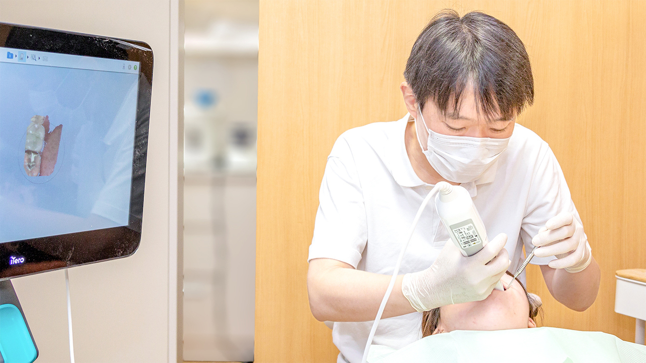 iTeroで治療後の歯並びをシミュレーションする画面