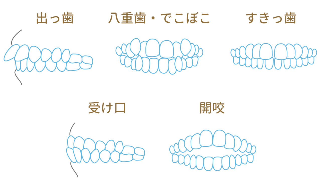 あなたの歯並びもきっとキレイに軽い症状・重い症状まとめてお任せ