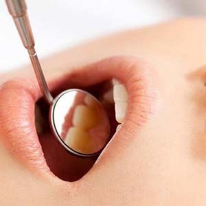 経過観察を受けている女性の口元のイメージ写真