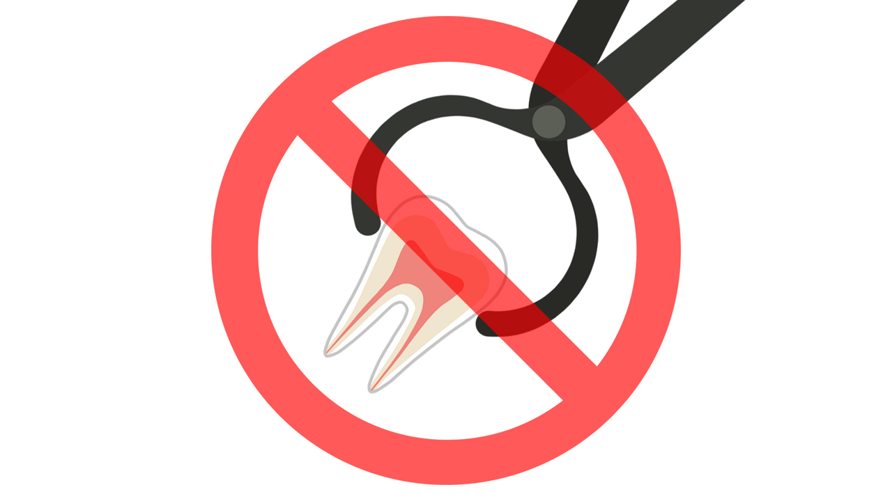 非抜歯矯正について紹介するページへのリンク