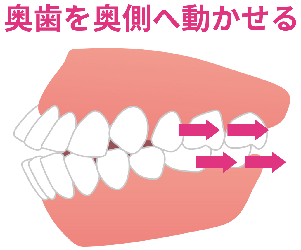 奥歯を後方に動くことがわかる歯のイラスト