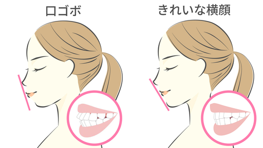 キレイラインとインビザラインの違い - 西宮市矯正歯科相談室
